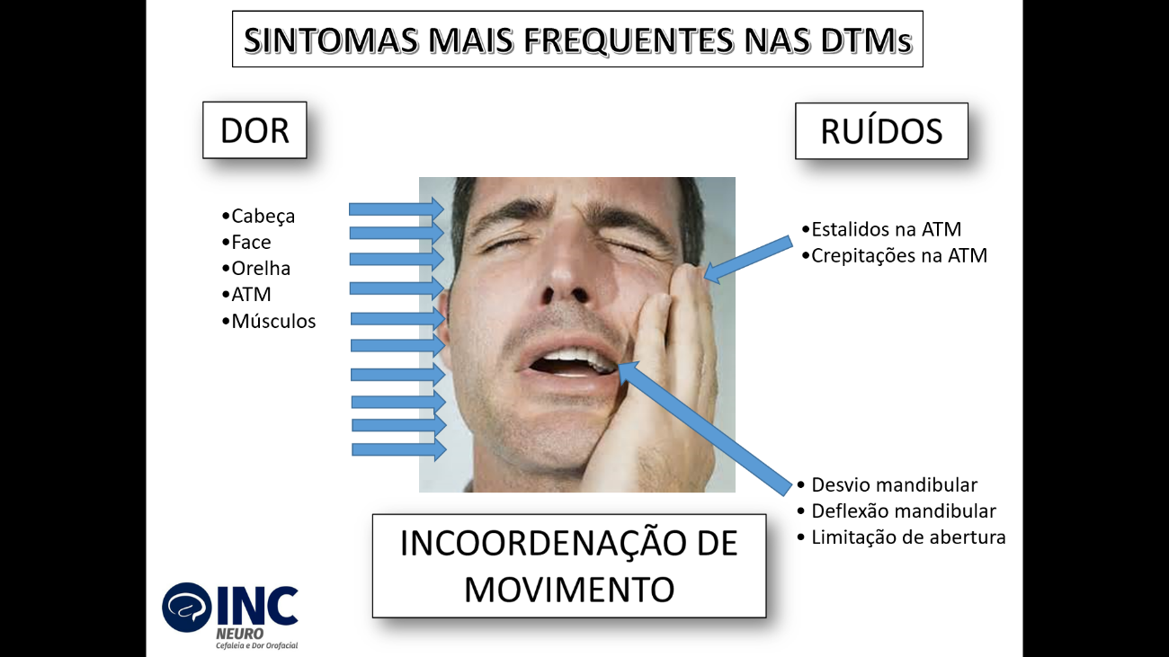 Referência em Bucomaxilofacial: ATM: Os principais sintomas das disfunções  da articulação temporomandibular (DTM)