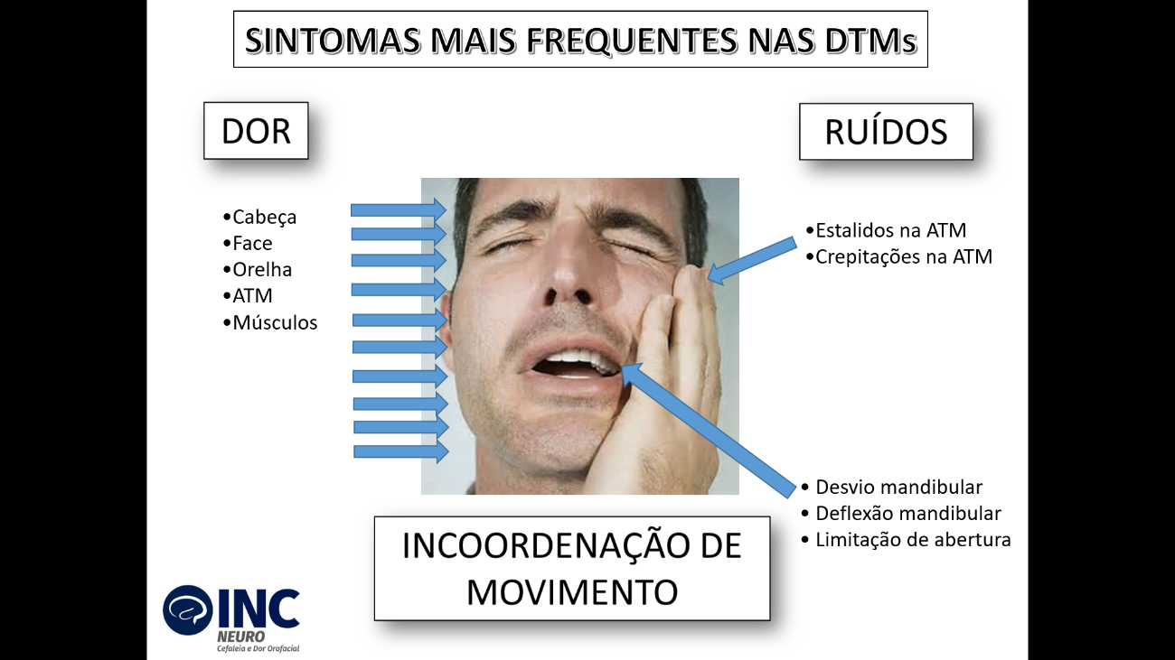 Dor na mandíbula e dor de cabeça - saiba a relação entre elas.